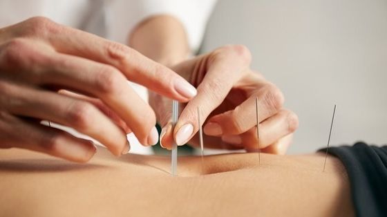 0.16mm Silver Intradermal Acupuncture Needles untuk meredakan rasa sakit
