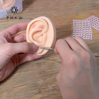 Biji Herbal Vaccaria Untuk Terapi Auricular Eksternal