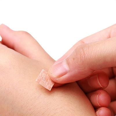 GB 2024-2016 Jarum Tekan Akupunktur 0.2mm X 1.5mm untuk Standar Keselamatan Properti Aparatus Pengobatan Tiongkok