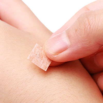 Acupuncture Needles Package Quantity 100 Piece Per Box Press And Release Metode Penempatan Acupuncture Press Needles